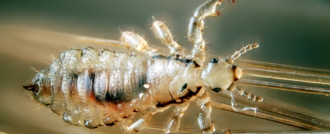 Head lice are nasty but they don't carry diseases. (flickr)