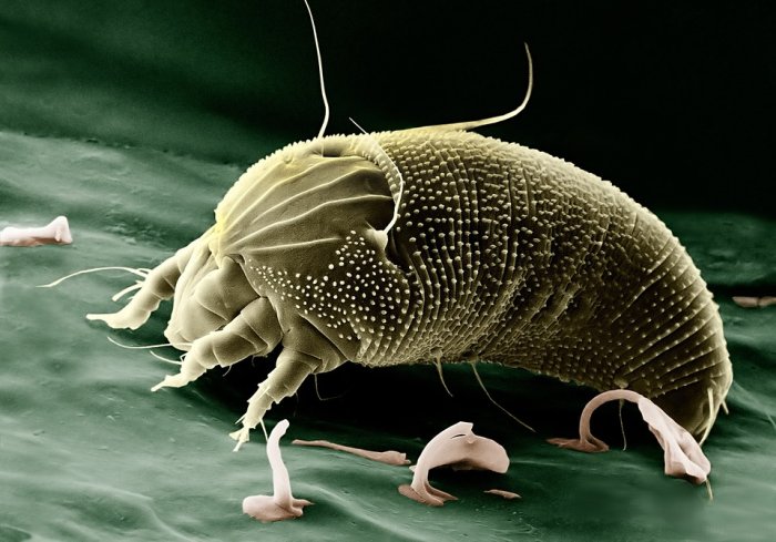 Microscopic Bugs That Live On Humans